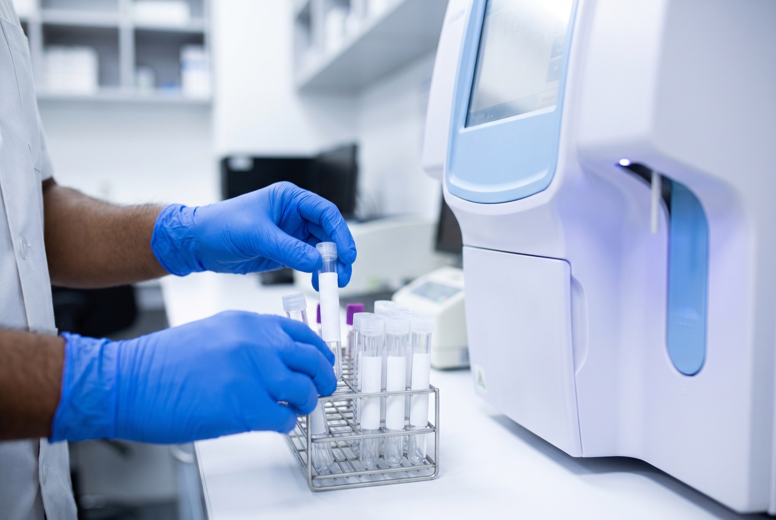 Blood sample tubes being placed in a laboratory rack