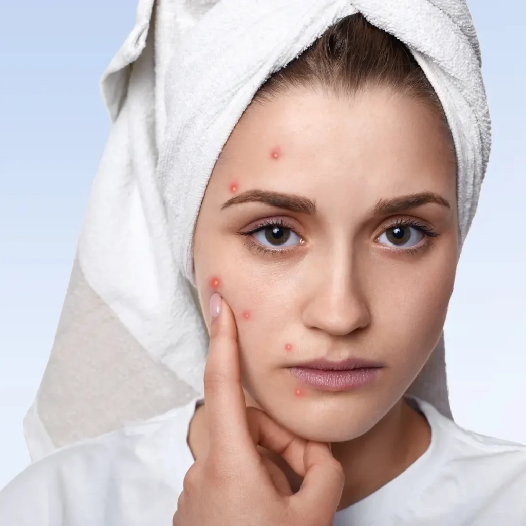 EVANI-HOSPITAL-Dermatology-Skin-Allergies-and-Rashes