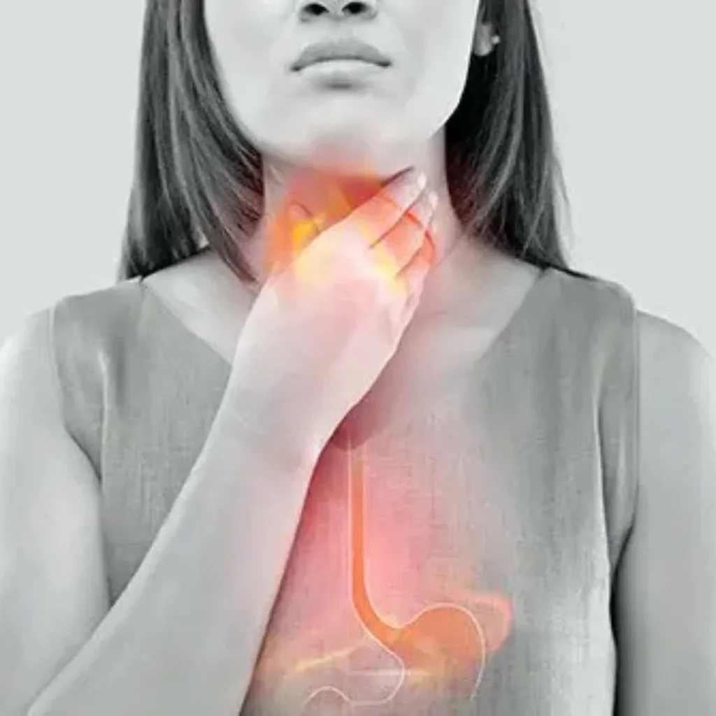 EVANI-HOSPITAL-Gastroenterology-Acid-Reflux