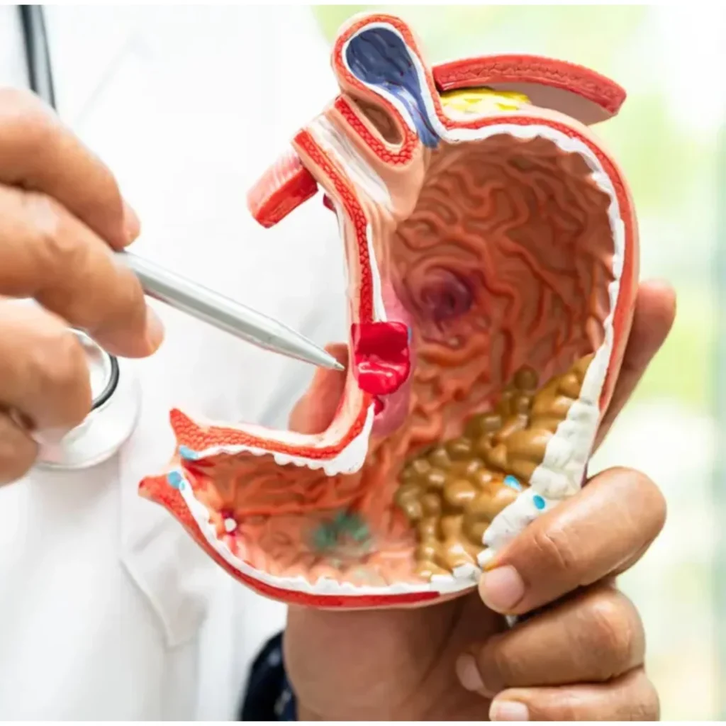 EVANI-HOSPITAL-Gastroenterology-Irritable-Bowel-Syndrome