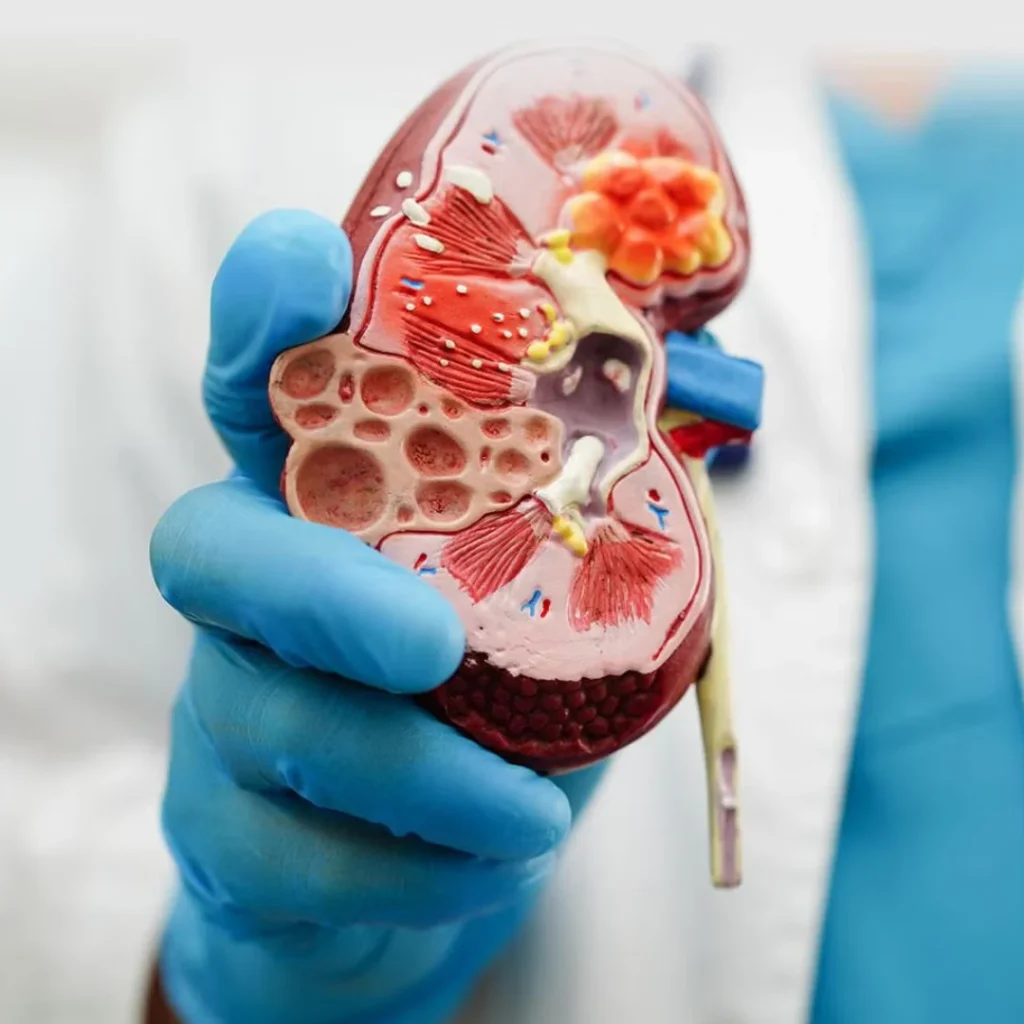 EVANI-HOSPITAL-Nephrology-Chronic-Kidney-Disease