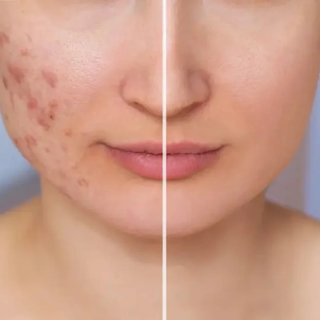 EVANI-HOSPITAL-Plastic-Surgery-Cyst-Soft-Tissue-Lump-Removal