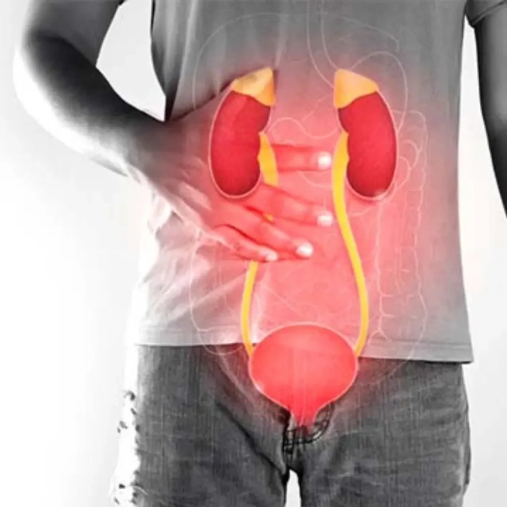 EVANI-HOSPITAL-Urology-Male-Urological-Conditions