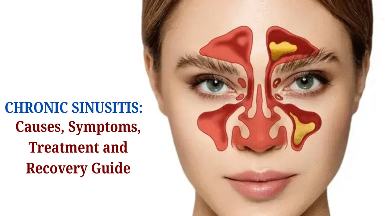 Chronic Sinusitis Causes, Symptoms, Treatment and Recovery Guide Evani Hospital